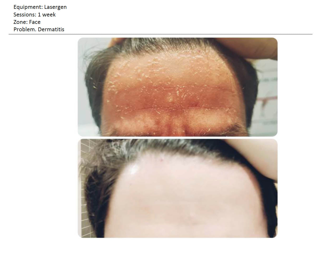 CREMA FACIAL LASERGEN